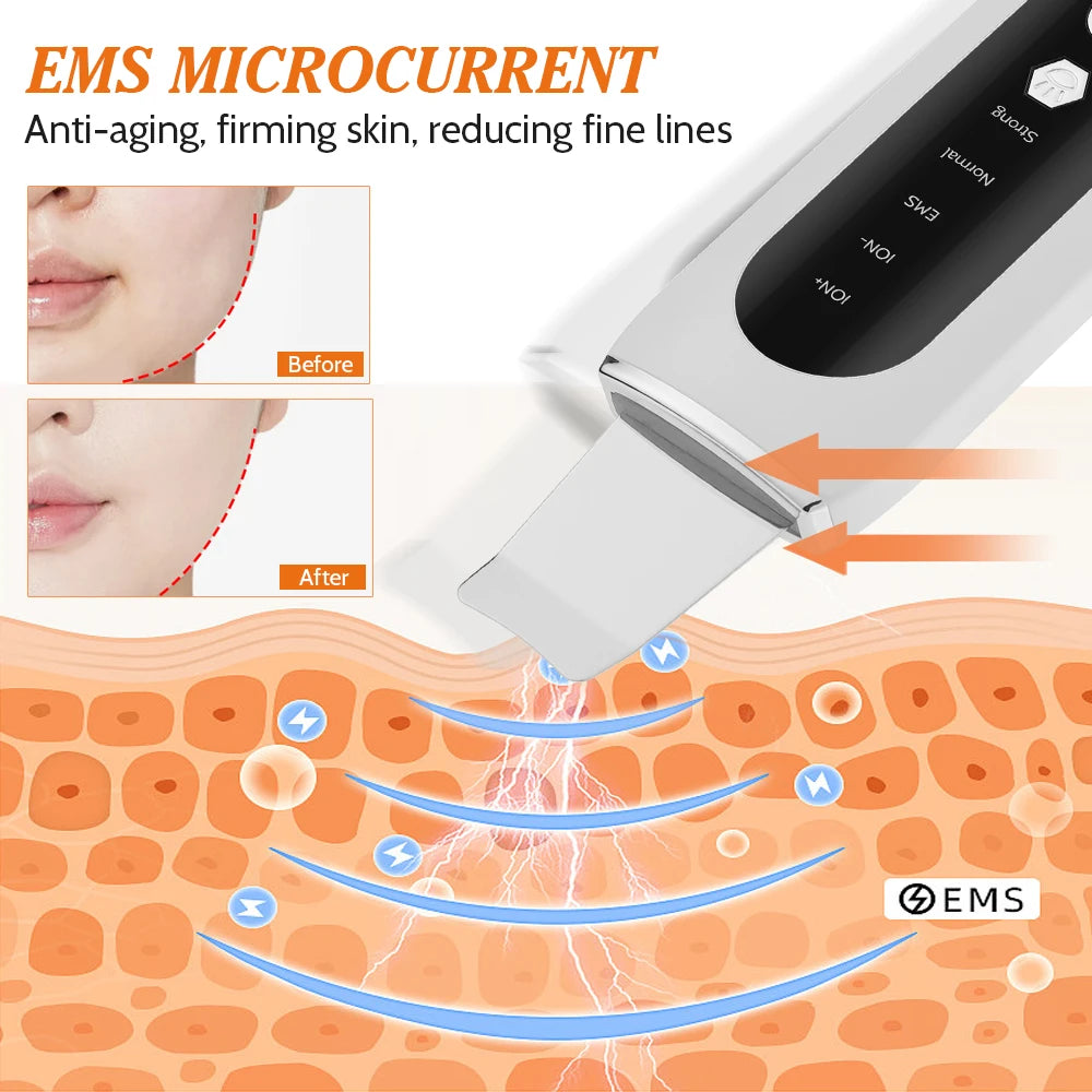 Ultrasonic Skin Scrubber Peeling Blackhead Remover