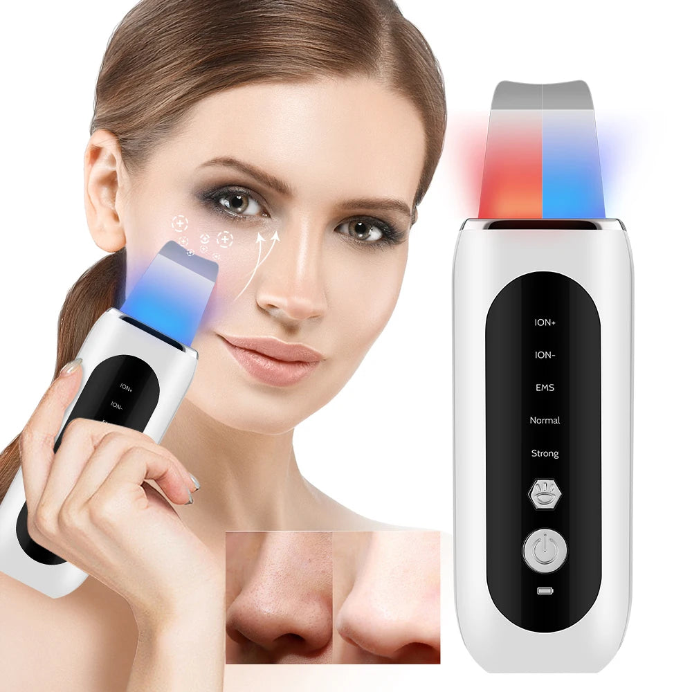 Ultrasonic Skin Scrubber Peeling Blackhead Remover
